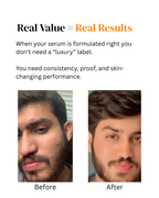 10% Vitamin C Glow Serum 30ml